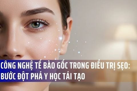 Công nghệ tế bào gốc trong điều trị sẹo: Bước đột phá y học tái tạo