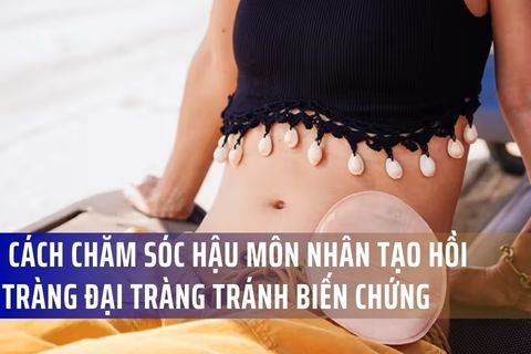 Bác sĩ Bệnh viện Việt Đức chia sẻ cách chăm sóc hậu môn nhân tạo hồi tràng đại tràng tránh biến chứng