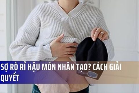 Sợ Rò Rỉ Hậu Môn Nhân Tạo? Cách Giải Quyết Từ Chuyên Gia Bệnh Viện Việt Đức