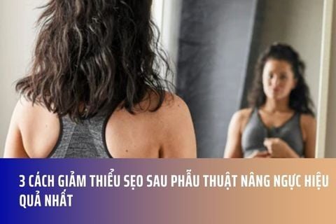3 CÁCH GIẢM THIỂU SẸO SAU PHẪU THUẬT NÂNG NGỰC HIỆU QUẢ NHẤT
