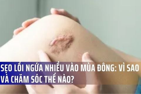 Sẹo lồi ngứa nhiều vào mùa đông: Vì sao và chăm sóc thế nào?