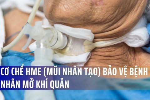 Cơ Chế HME (Mũi Nhân Tạo) Bảo Vệ Bệnh Nhân Mở Khí Quản