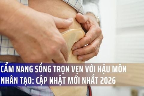 Cẩm Nang Sống Trọn Vẹn Với Hậu Môn Nhân Tạo: Cập Nhật Mới Nhất 2026