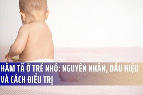 Hăm Tã Ở Trẻ Nhỏ: Nguyên Nhân, Dấu Hiệu Và Cách Điều Trị