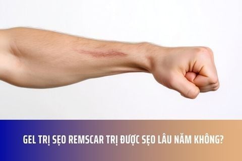 Gel trị sẹo RemScar trị được sẹo lâu năm không?