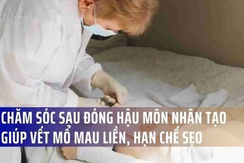 Chăm sóc sau đóng hậu môn nhân tạo giúp vết mổ mau liền, hạn chế sẹo