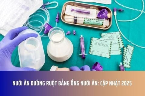 Nuôi Ăn Đường Ruột Bằng Ống Nuôi Ăn: Cập Nhật 2025