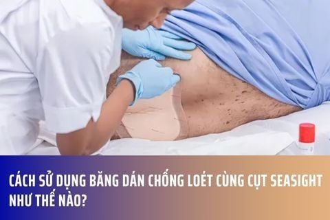 Cách sử dụng băng dán chống loét cùng cụt Seasight như thế nào?