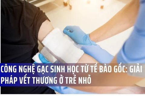 Công Nghệ Gạc Sinh Học Mới Từ Tế Bào Gốc: Giải Pháp Cho Vết Thương Khó Lành Ở Trẻ Nhỏ