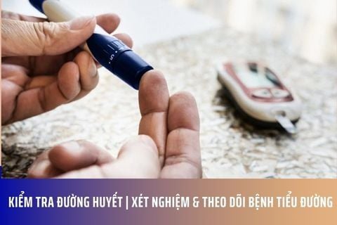 Kiểm Tra Đường Huyết | Xét Nghiệm & Theo Dõi Bệnh Tiểu Đường