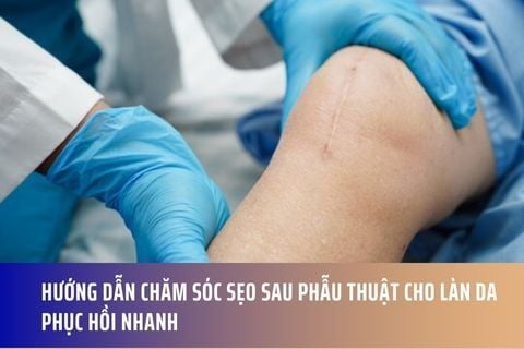 Hướng Dẫn Chăm Sóc Sẹo Sau Phẫu Thuật Cho Làn Da Phục Hồi Nhanh