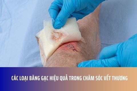 Các Loại Băng Gạc Hiệu Quả Trong Chăm Sóc Vết Thương
