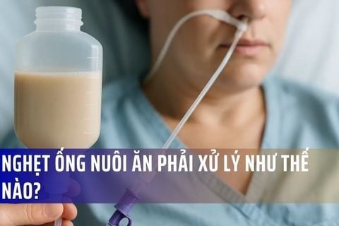 Nghẹt ống nuôi ăn phải xử lý như thế nào?