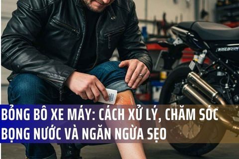 Bỏng bô xe máy: Cách xử lý, chăm sóc bọng nước và ngăn ngừa sẹo