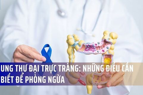 Ung Thư Đại Trực Tràng: Xu Hướng Gia Tăng Và Những Điều Cần Biết Để Phòng Ngừa