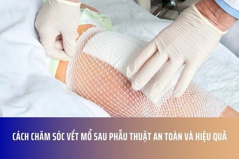 Cách Chăm Sóc Vết Mổ Sau Phẫu Thuật An Toàn Và Hiệu Quả