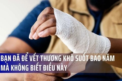 Bạn đã để vết thương KHÔ suốt bao năm mà không biết điều này