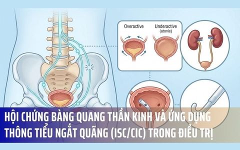 Hội Chứng Bàng Quang Thần Kinh Và Ứng Dụng Thông Tiểu Ngắt Quãng (Isc/Cic) Trong Điều Trị