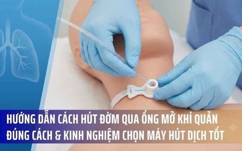 Hướng Dẫn Cách Hút Đờm Qua Ống Mở Khí Quản Đúng Cách & Kinh Nghiệm Chọn Máy Hút Dịch Tốt