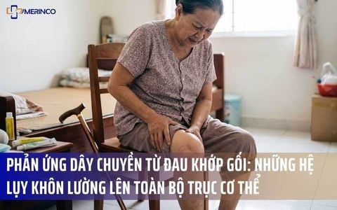 Phản Ứng Dây Chuyền Từ Đau Khớp Gối: Những Hệ Lụy Khôn Lường Lên Toàn Bộ Trục Cơ Thể