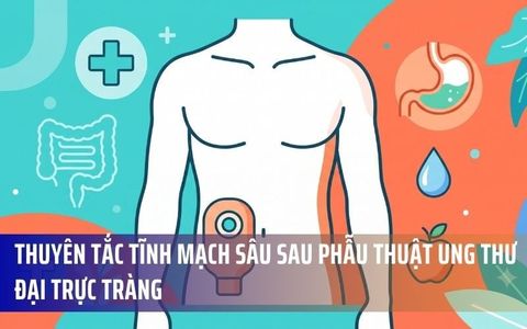 Thuyên Tắc Tĩnh Mạch Sâu Sau Phẫu Thuật Ung Thư Đại Trực Tràng