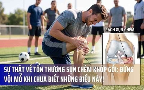 Sự Thật Về Tổn Thương Sụn Chêm Khớp Gối: Đừng Vội Mổ Khi Chưa Biết Những Điều Này!