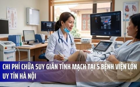 Chi Phí Chữa Suy Giãn Tĩnh Mạch Tại 5 Bệnh Viện Lớn Uy Tín Hà Nội