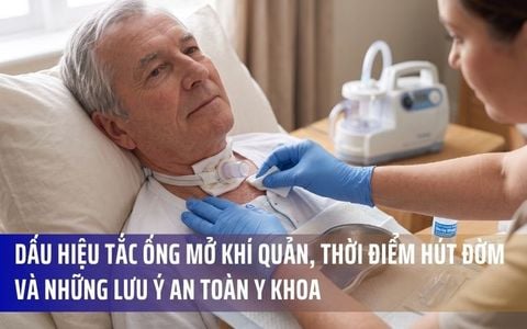 Dấu Hiệu Tắc Ống Mở Khí Quản, Thời Điểm Hút Đờm Và Những Lưu Ý An Toàn Y Khoa