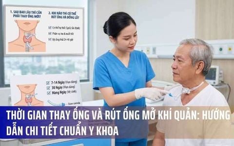 Thời Gian Thay Ống Và Rút Ống Mở Khí Quản: Hướng Dẫn Chi Tiết Chuẩn Y Khoa