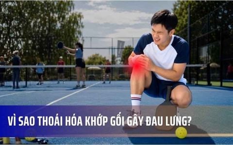 Hội Chứng Gối - Cột Sống: Vì Sao Thoái Hóa Khớp Gối Gây Đau Lưng?