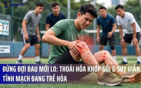 Đừng Đợi Đau Mới Lo: Thoái Hóa Khớp Gối & Suy Giãn Tĩnh Mạch Đang Trẻ Hóa