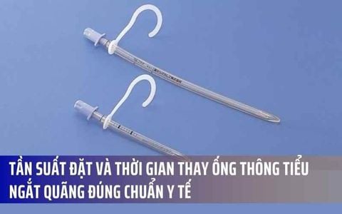 Tần Suất Đặt Và Thời Gian Thay Ống Thông Tiểu Ngắt Quãng Đúng Chuẩn Y Tế