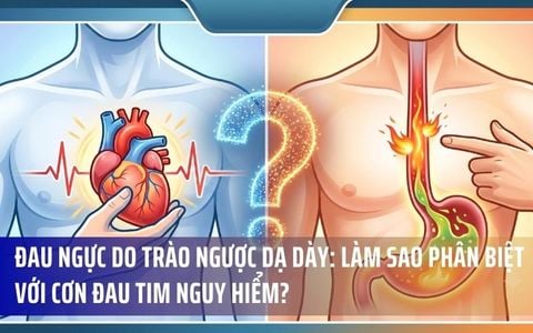 Đau Ngực Do Trào Ngược Dạ Dày: Làm Sao Phân Biệt Với Cơn Đau Tim Nguy Hiểm?