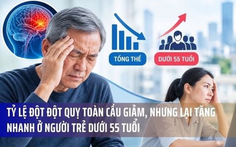 Tỷ Lệ Đột Đột Quỵ Toàn Cầu Giảm, Nhưng Lại Tăng Nhanh Ở Người Trẻ Dưới 55 Tuổi