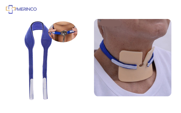 dây cố định mở khí quản