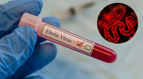 WHO cảnh báo khẩn về Ebola, Bộ Y tế yêu cầu tăng cường giám sát, ngăn dịch xâm nhập