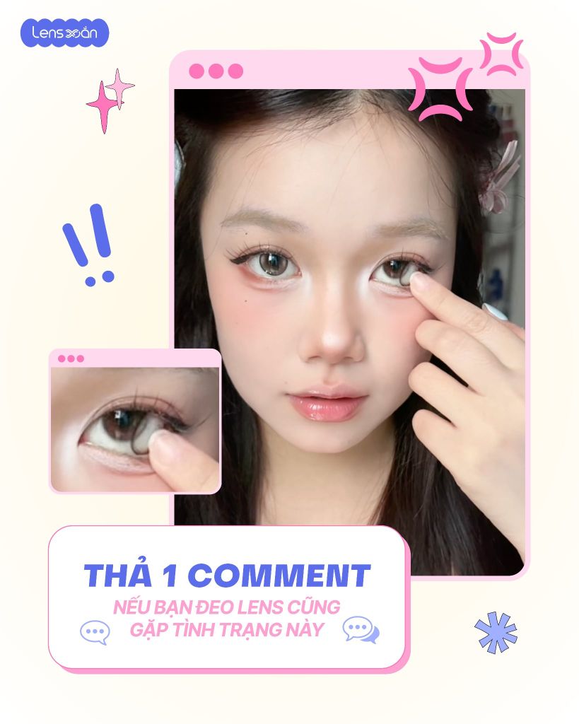 Hướng dẫn chọn Base Curve (B.C) phù hợp để tránh đeo lens bị trôi, đỏ mắt và khô mắt