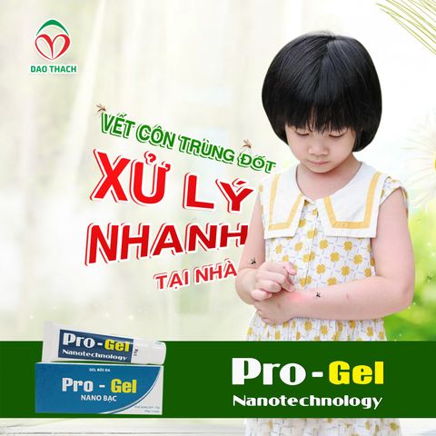 VẾT CÔN TRÙNG ĐỐT - XỬ LÝ NHANH TẠI NHÀ
