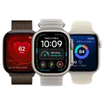 AppleCare+ cho Watch