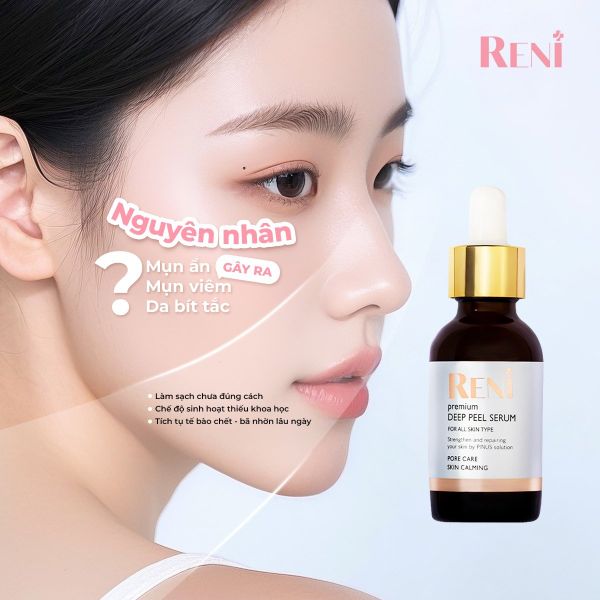 LÀM RÕ NGUYÊN NHÂN - LOẠI BỎ MỤN ẨN TỪ GỐC