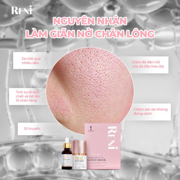 NGUYÊN NHÂN GÂY GIÃN NỞ LỖ CHÂN LÔNG - HIỂU ĐÚNG ĐỂ CẢI THIỆN