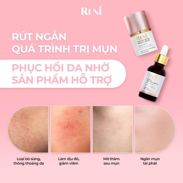 RÚT NGẮN QUÁ TRÌNH TRỊ MỤN - PHỤC HỒI DA NHANH HƠN NHỜ BỘ ĐÔI NÀY