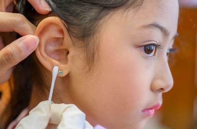 Mẹo Xử Lý Lỗ Đeo Bông Tai Bị Hôi