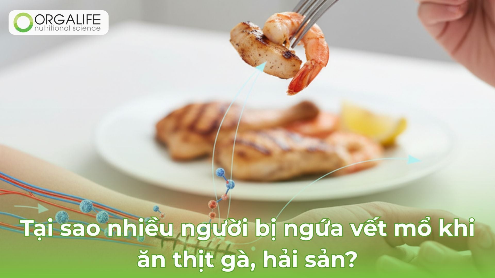 Tại sao nhiều người bị ngứa vết mổ khi ăn thịt gà, hải sản?