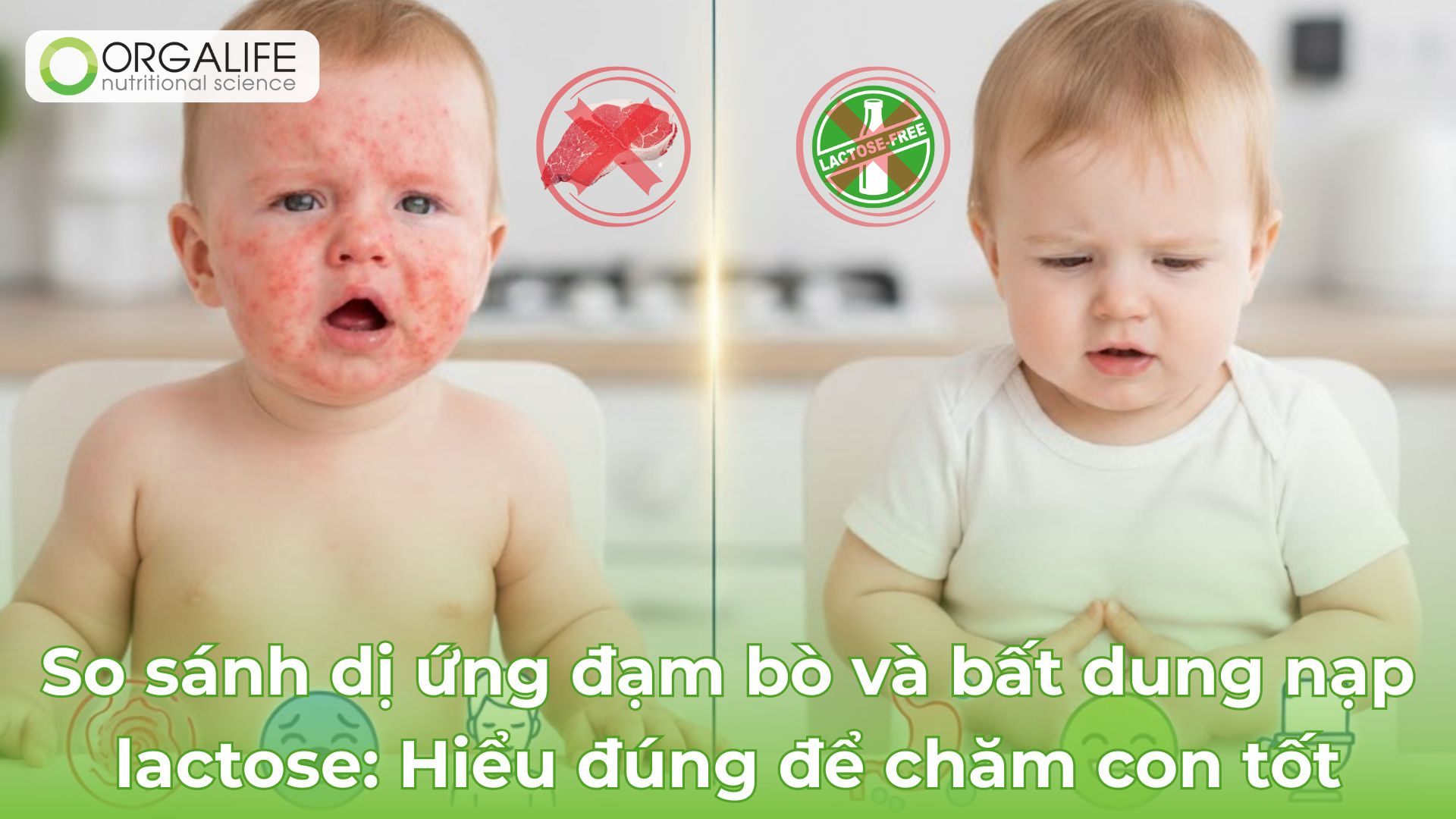 So sánh dị ứng đạm bò và bất dung nạp lactose: Hiểu đúng để chăm con tốt