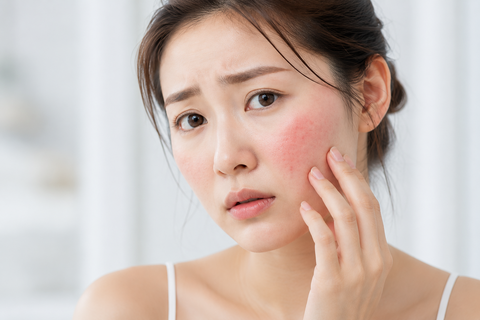 Da bị tổn thương do treatment phục hồi thế nào? 5 cách giúp da khỏe trở lại nhanh chóng