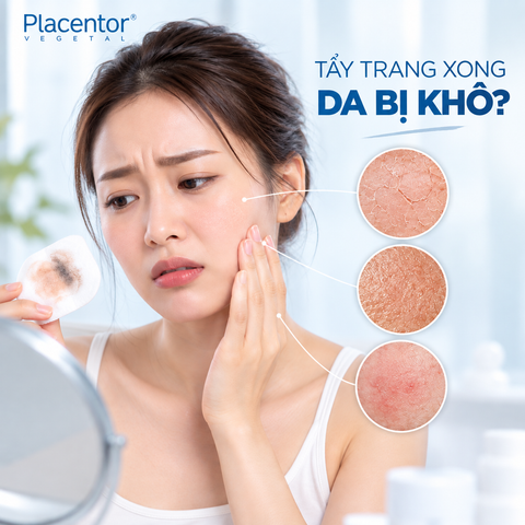 Nước Tẩy Trang Nào Không Làm Khô Da? Hiểu Đúng Về Cơ Chế Làm Sạch Và Hàng Rào Bảo Vệ Da