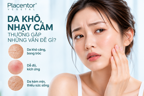Kem Dưỡng Cho Da Khô, Nhạy Cảm: Chọn Thế Nào Để Da Ẩm Mịn Và Ít Kích Ứng?