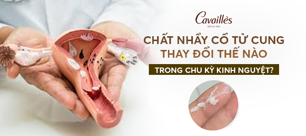 Chất nhầy như thế nào là sắp có kinh? Dấu hiệu nhận biết chính xác