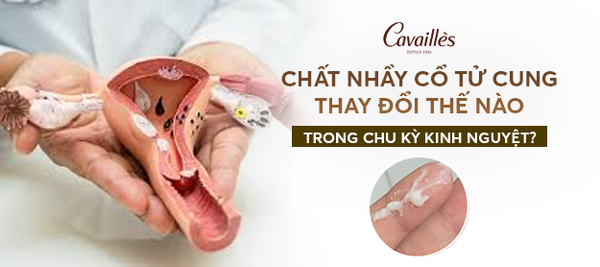 Chất nhầy như thế nào là sắp có kinh? Dấu hiệu nhận biết chính xác